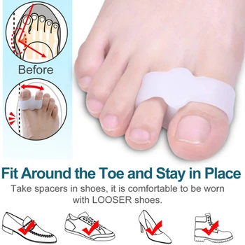 2 шт. Силиконовый сепаратор для ног и пальцев ног Hallux Valgus Корректор для облегчения боли в ногах