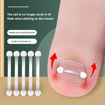 Инструменты для ногтей на ногах Педикюр Восстановление Embed Лечение ногтей на ногах Профессиональный инструмент для коррекции вросшего ногтя