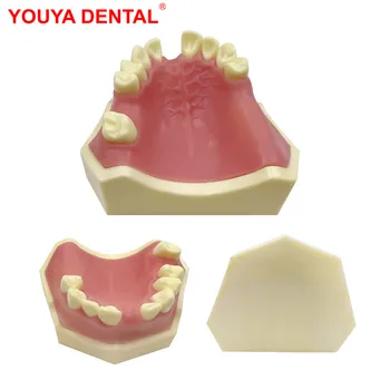 Стоматологическая модель Модель обучения зубов Практика имплантатов Модель зубов для студентов-стоматологов Стоматолог Обучение Экзаменационная стоматология